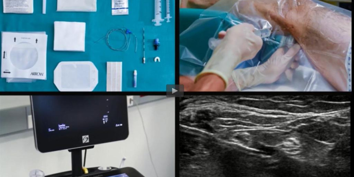Ultrason (US) Eşliğinde Fasya Blokları