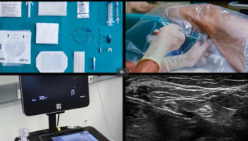 Ultrason (US) Eşliğinde Fasya Blokları