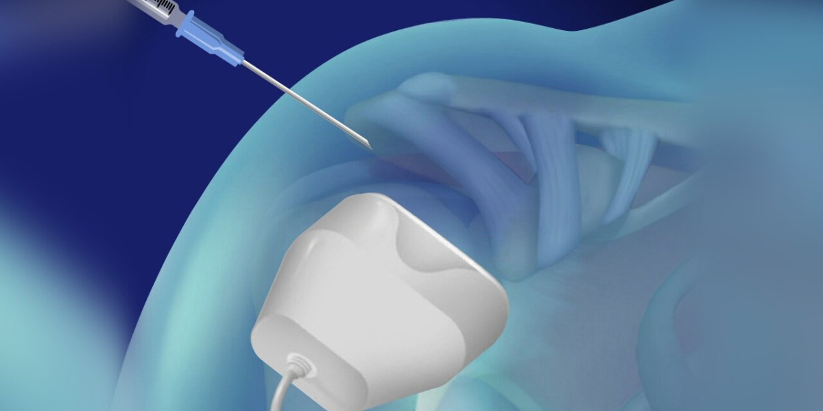 Ultrasonografi (USG) Eşliğinde Enjeksiyon